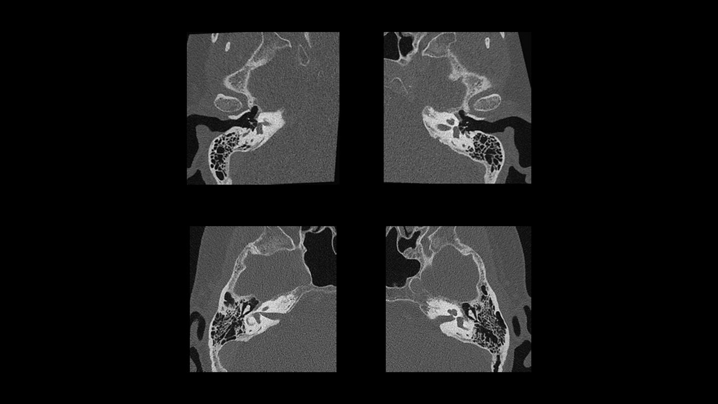 Neuro Imaging