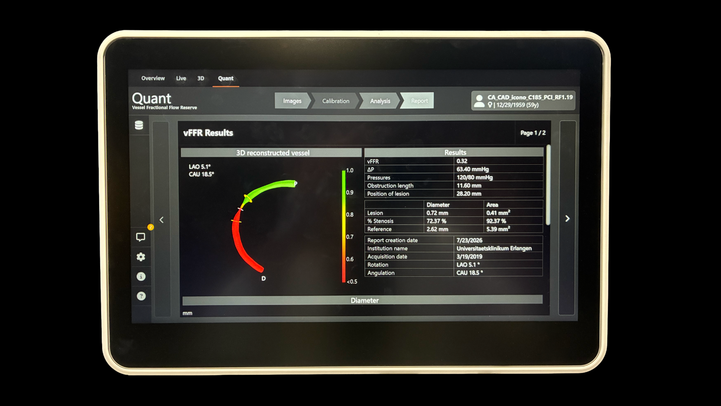 Result overview dashboard