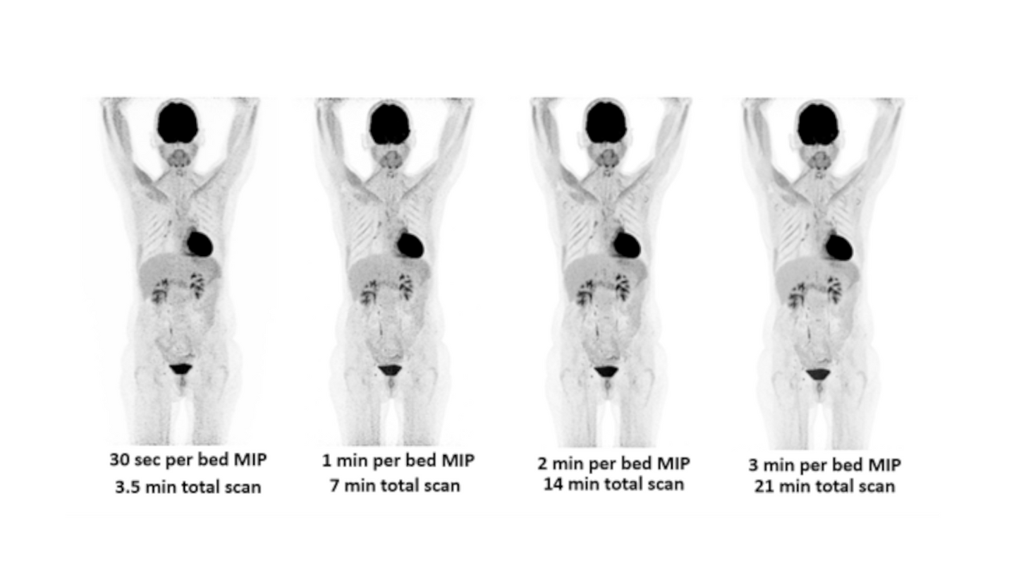 Biograph Vision clinical image 2
