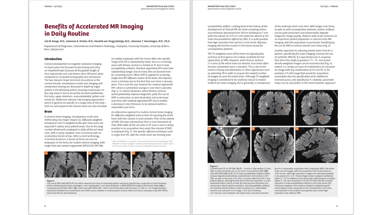 siemens-healthineers_Magnetomworld_Accelerated-MR-Imaging-Routine