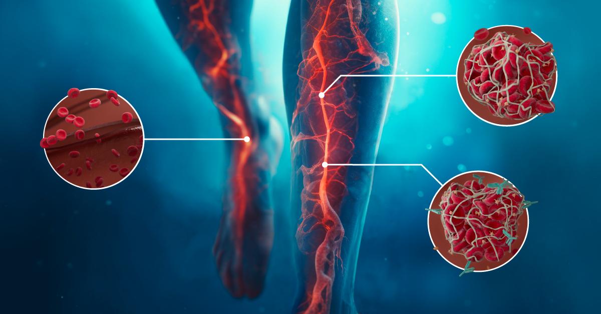 Hemostasis Learning Institute Master Class 2025