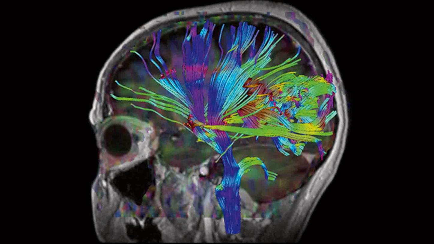 MR– Better Understanding 3T Imaging