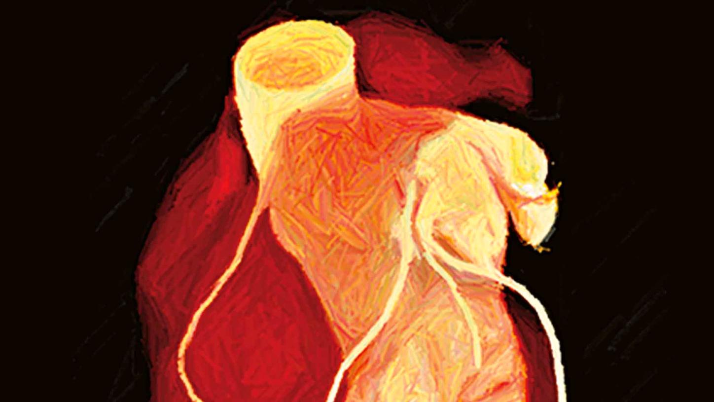Cardiac CT with syngo.via