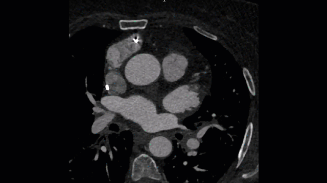 clinical_proof_1_CT_techniques