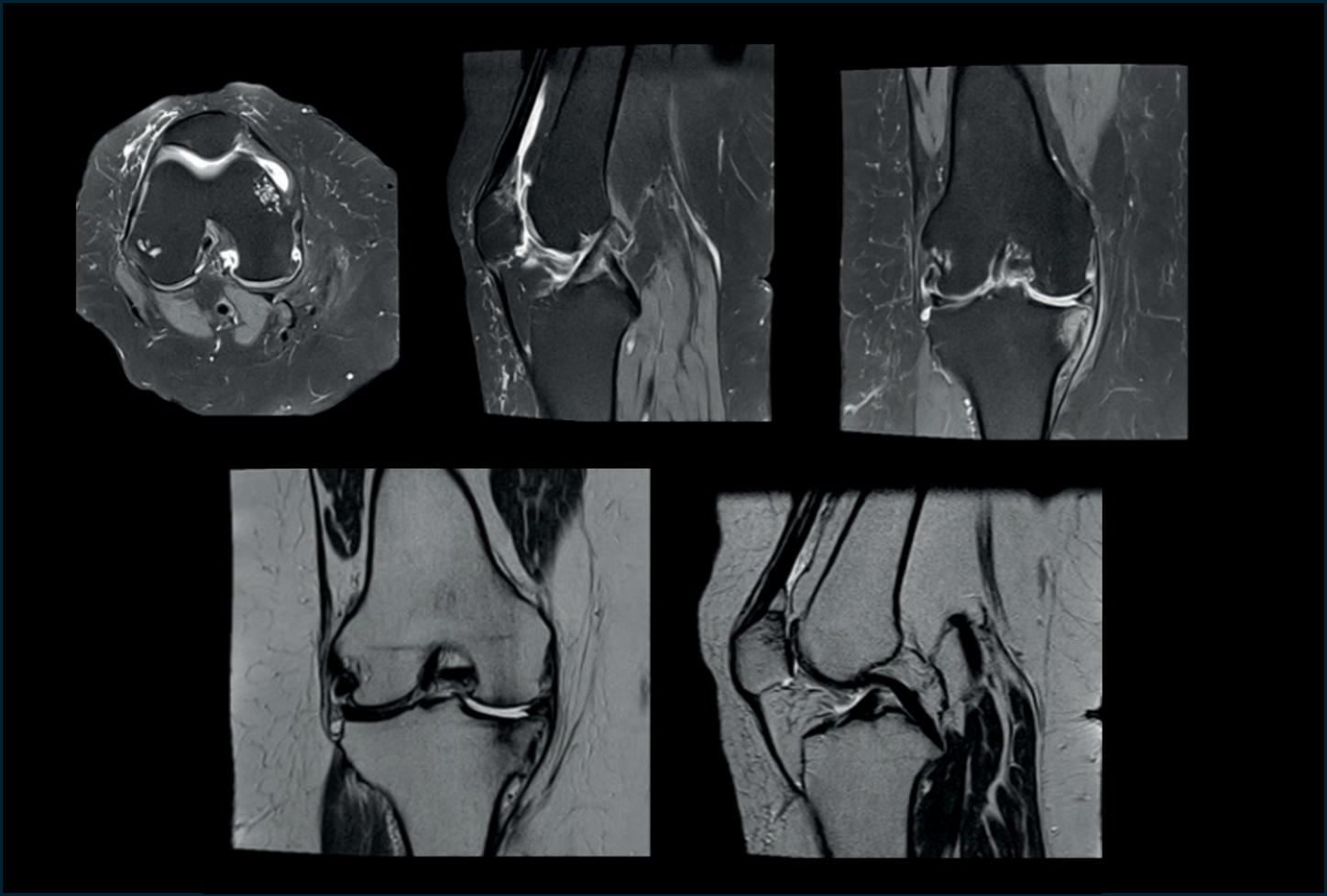 Knee MRI Medray