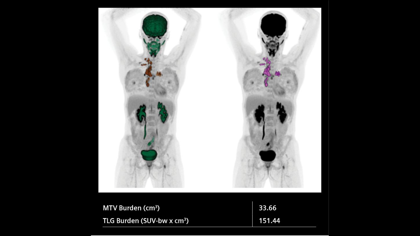 PET/CT in pregnant patients