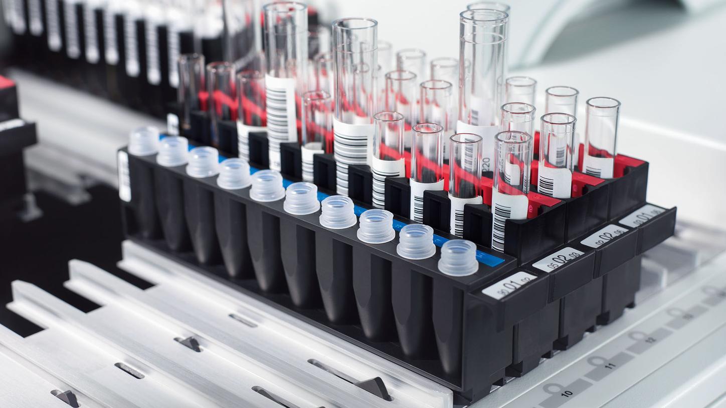 Sample tubes and reaction vessels loaded on the BN II System for high-volume testing