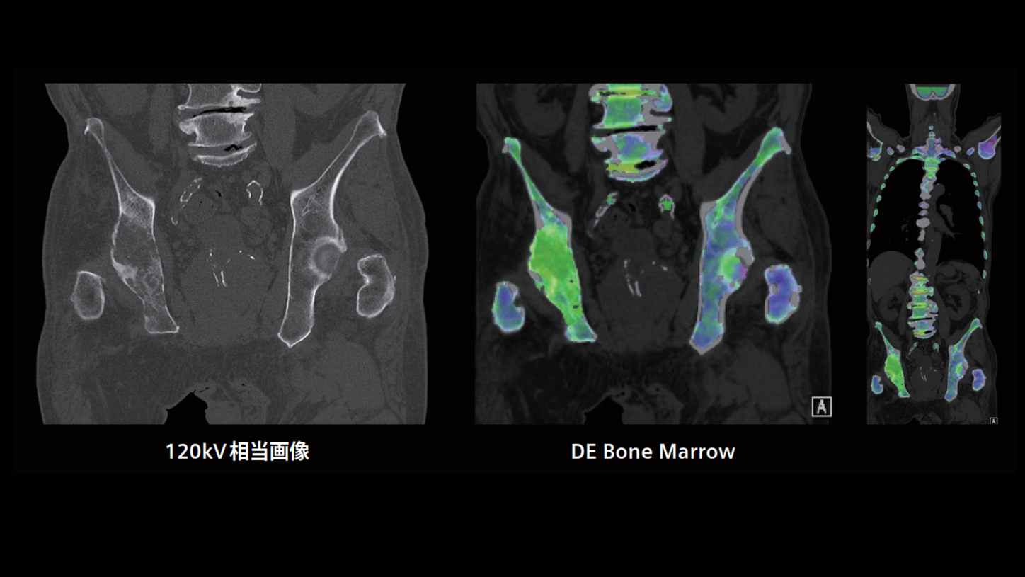 JP-CT-Pro.Pulse_CaseRport_vol.1-3