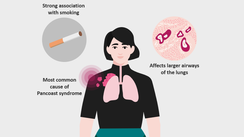 Effects of Smoking SCC