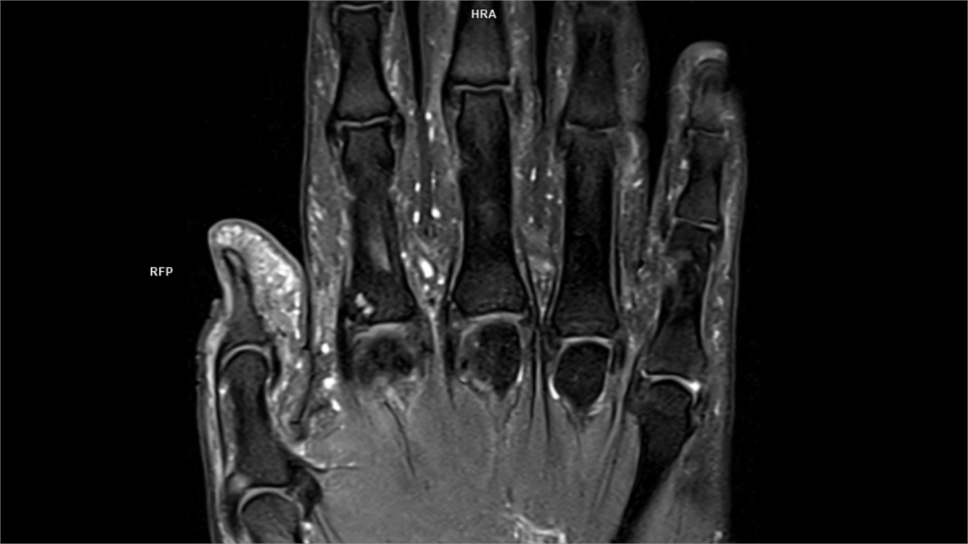 PD Coronal FS DR Sharp Lumina