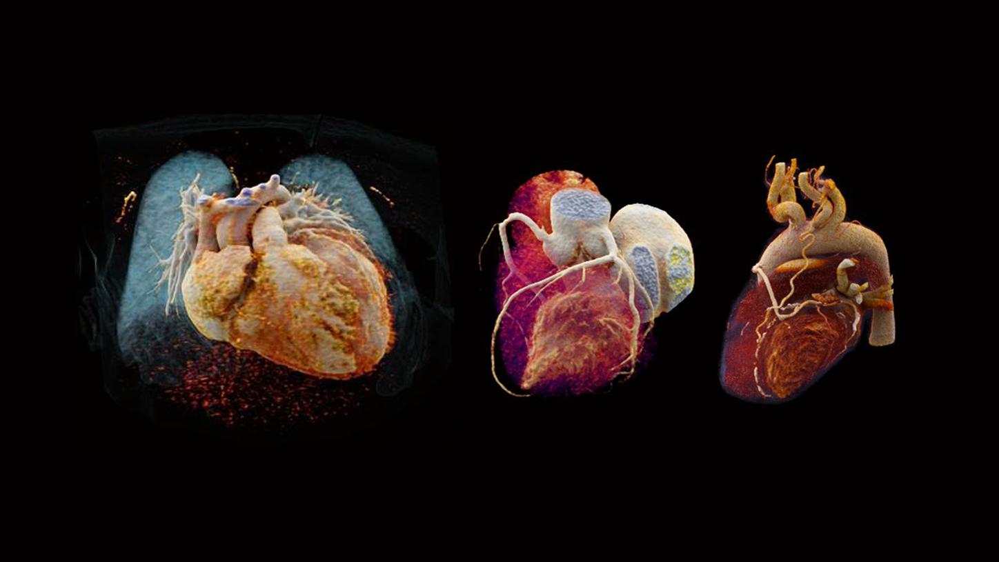 DSCT cardiac imaging whitepaper