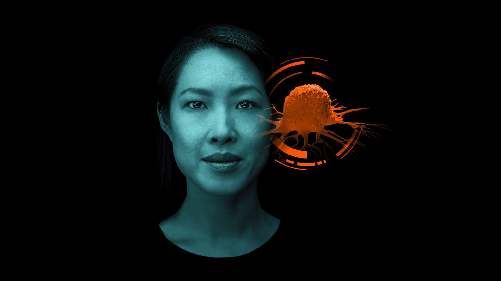 Cancer Screening Programs Siemens Healthineers Finland Cancer Screening Programs Siemens Healthineers Finland