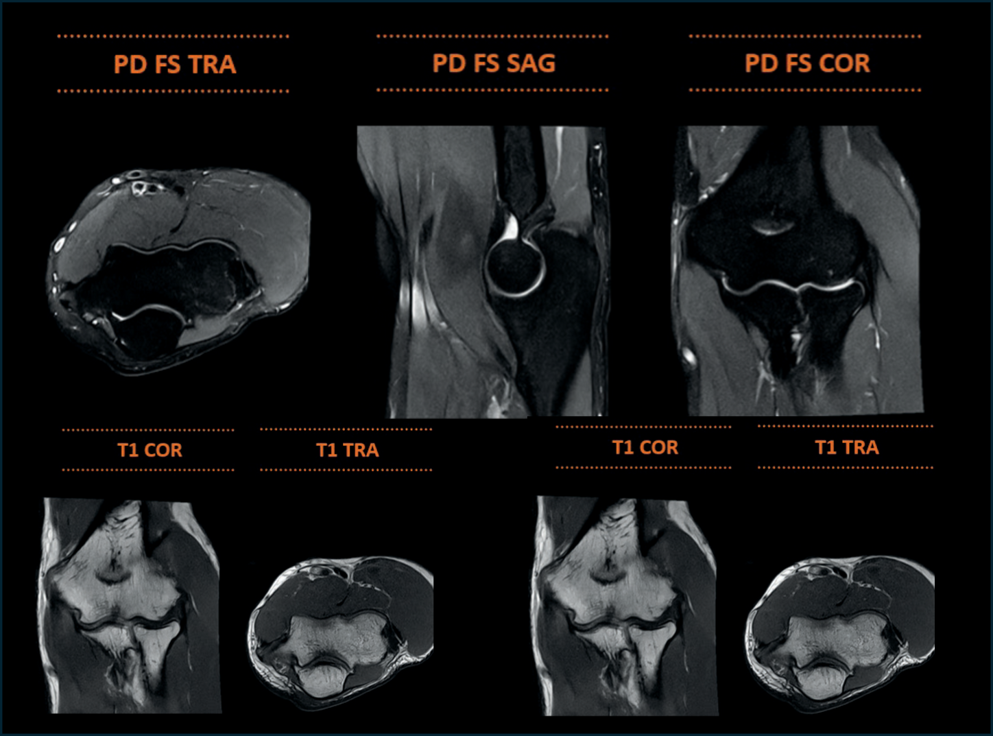 Elbow MRI Medray