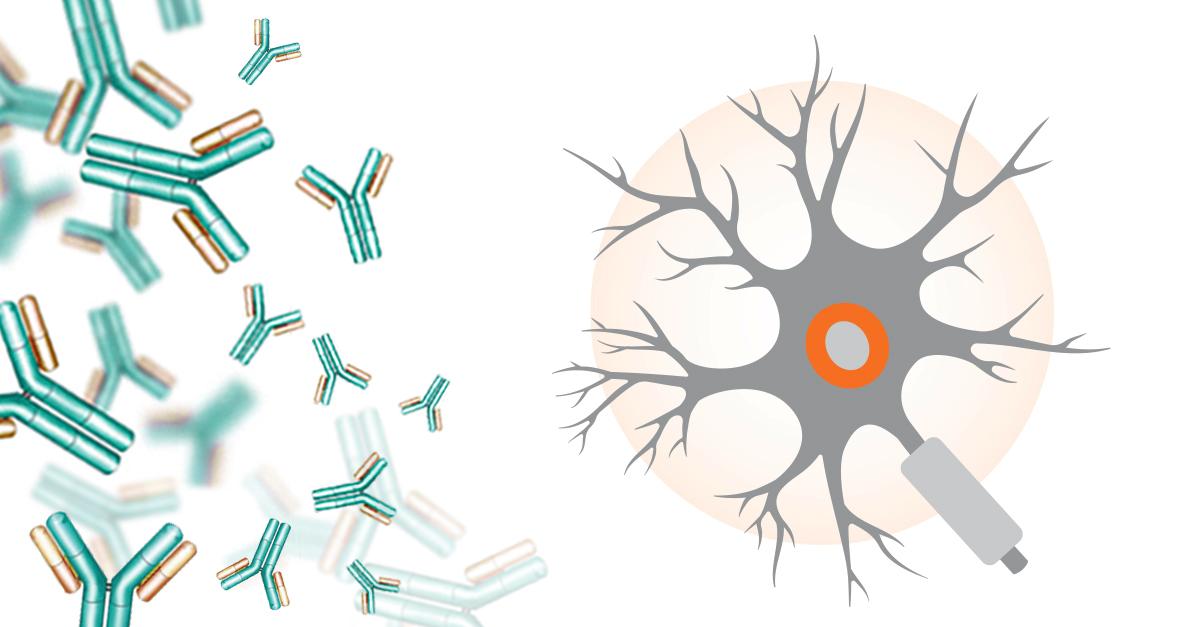 N Latex FLC kappa and lambda Assays