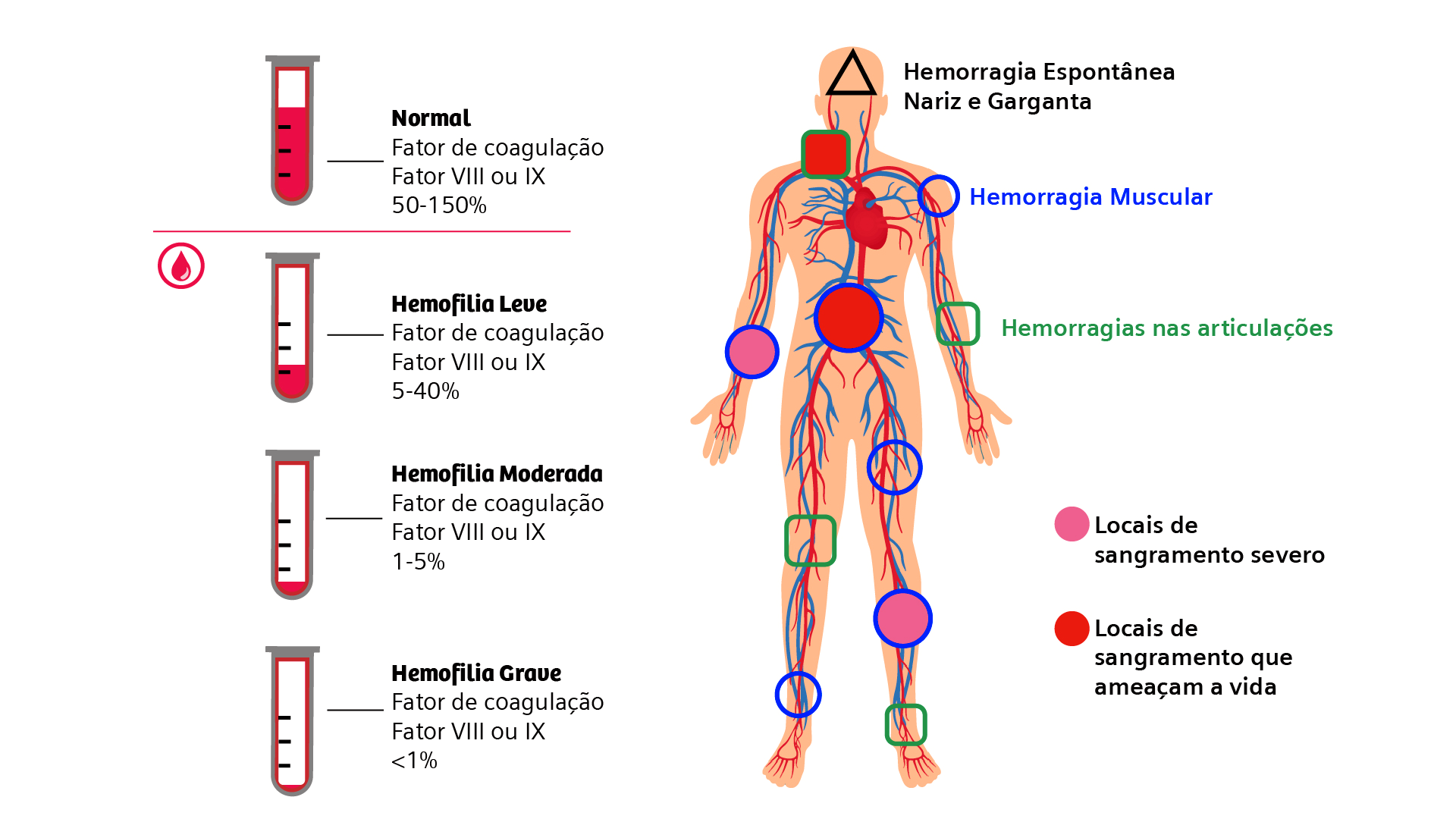 O que é hemofilia? - Siemens Healthineers Brasil