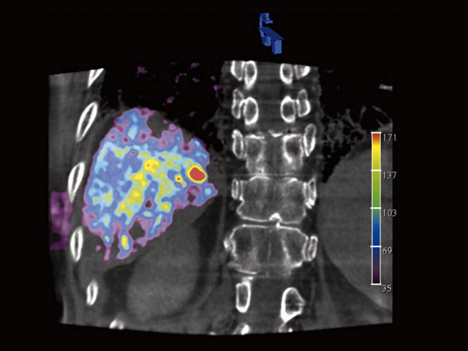 syngo dyna pbv stud proto