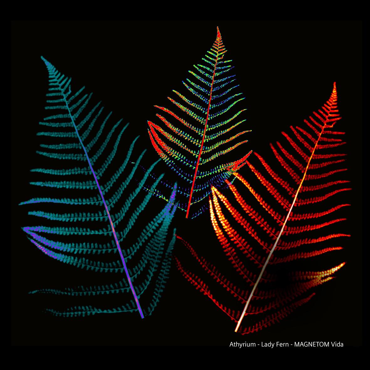 Siemens-healthineers_Magnetomworld_Lady_Fern_Vida