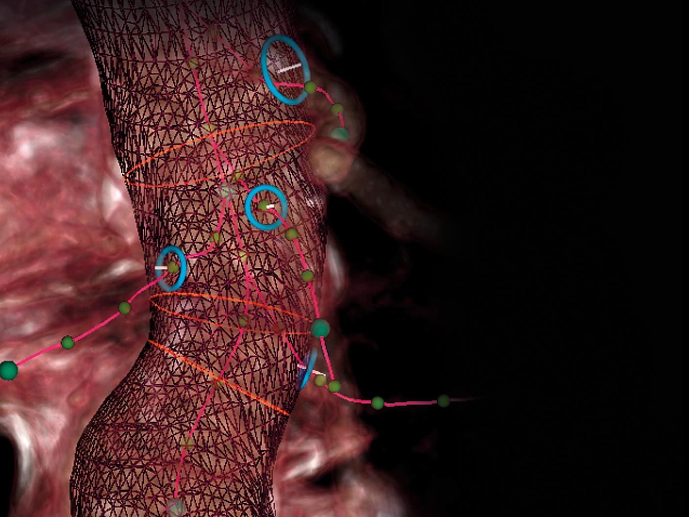 Optimal preparation of CT data