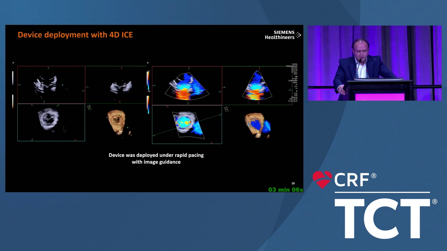 AT CVX TCT 2024 SHD interventions worldwide