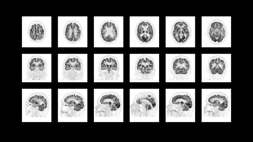 Biograph Trinion PET/CT scanner - Siemens Healthineers Japan