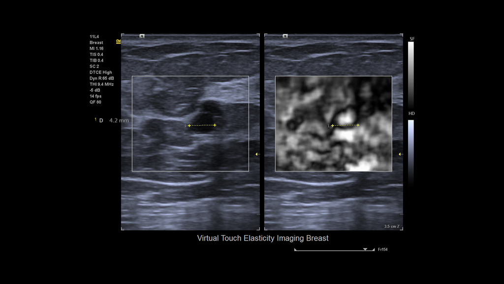 ACUSON Juniper Ultrasound System Siemens Healthineers USA