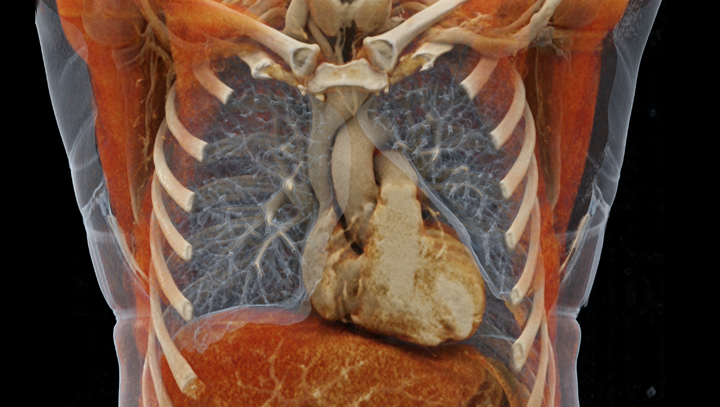 Hoe één CT-scan preventieve diagnostiek kan veranderen