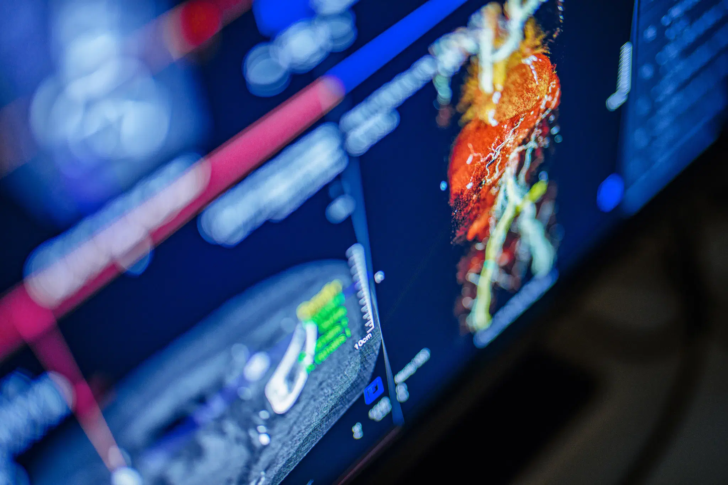 From innovation to impact: How AI elevates patient care