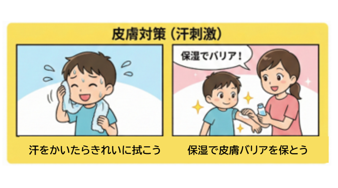 季節性アレルギー(汗アレルギー)