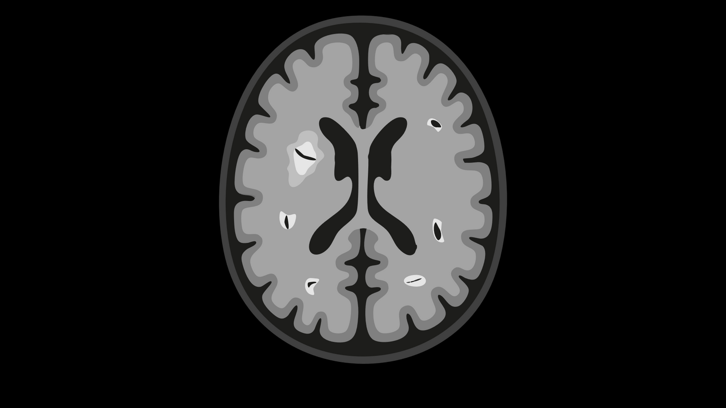 Dissemination in space (DIS)