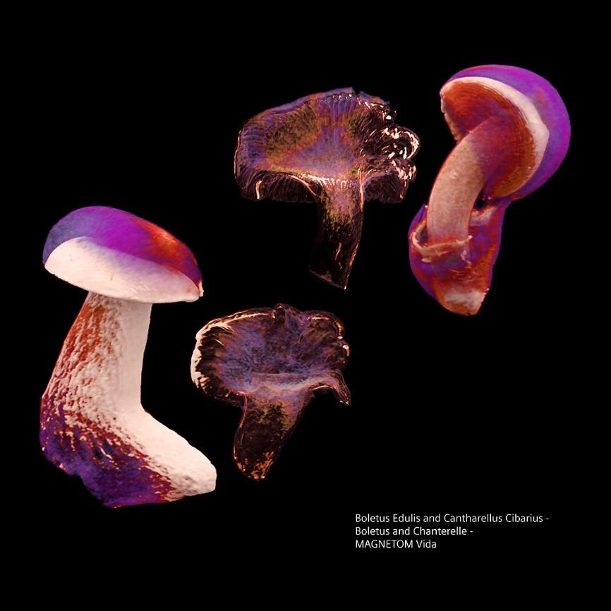 Siemens-healthineers_Magnetomworld_Mushrooms_coloured_Vida