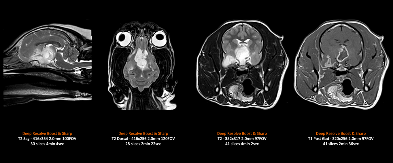 MAGNETOM Sempra – Cat Brain (8Ch Small Flex)