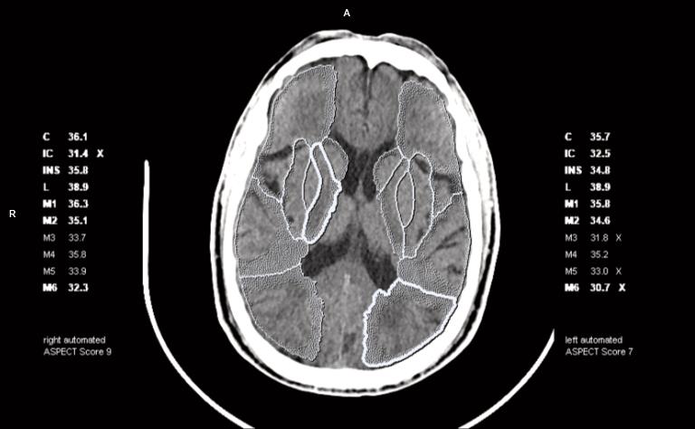 CT Imaging