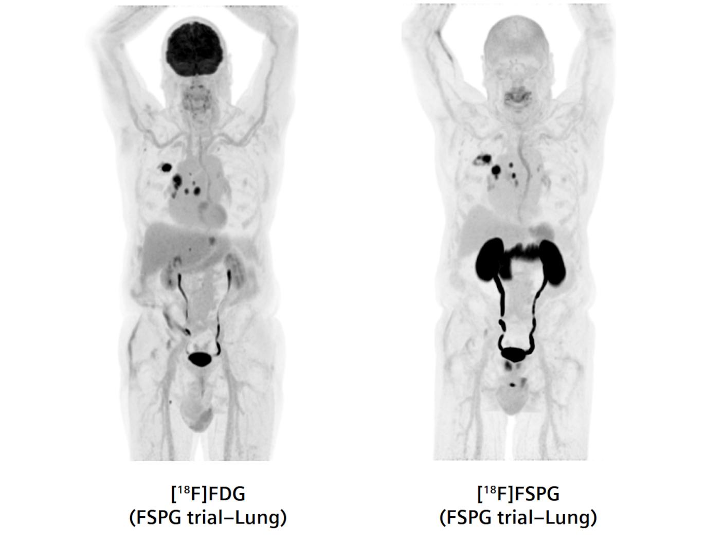 Comparison between the tracer uptake.