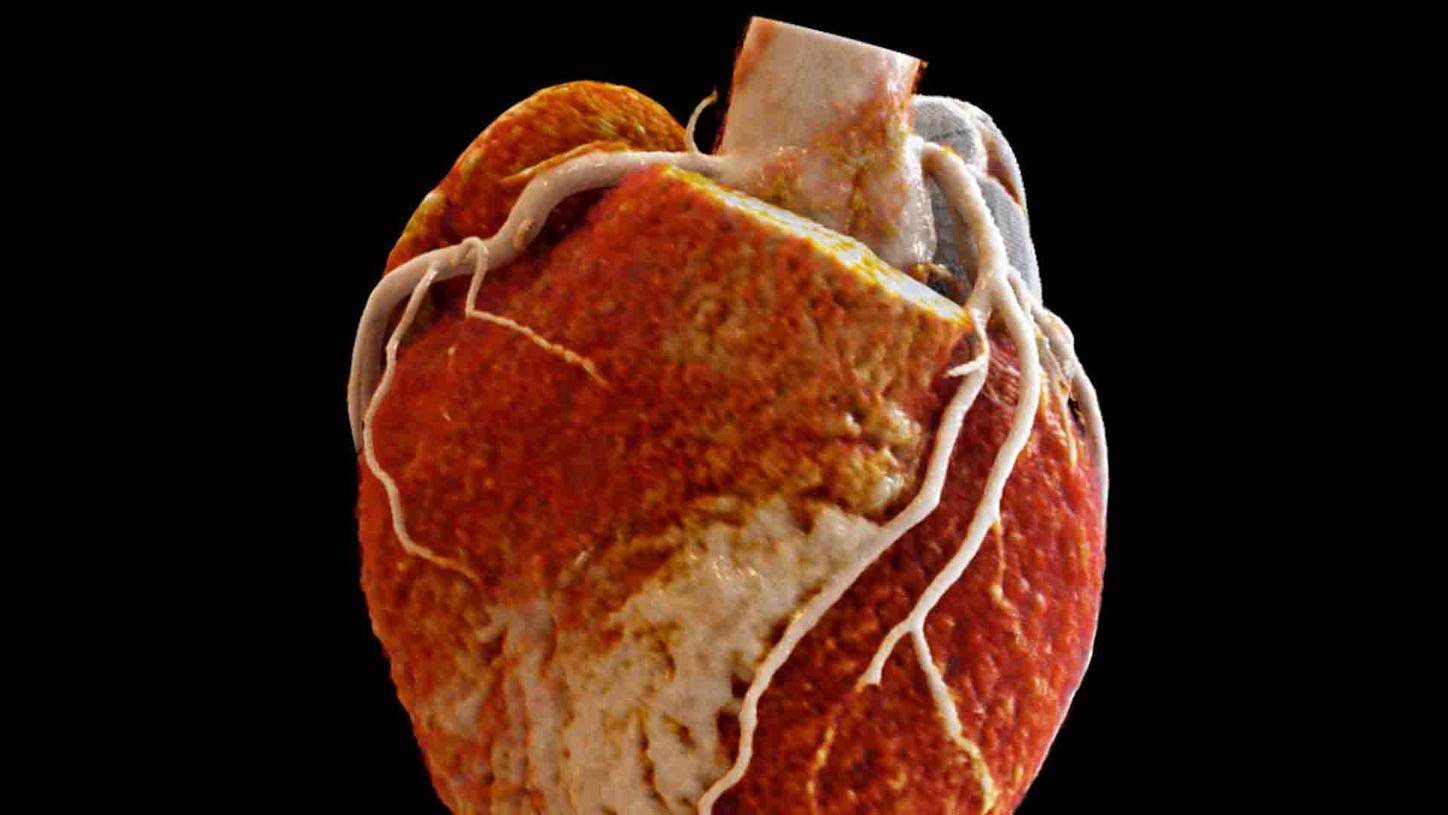 syngo.via – Cardiovascular Workflows CT and MR