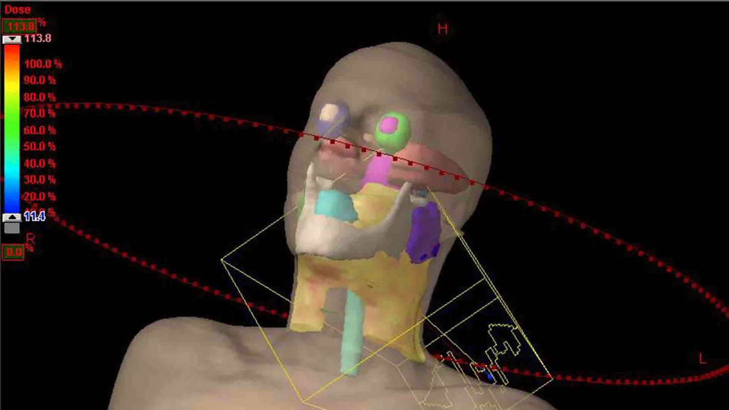 EC204EU-Varian Advanced Techniques Physics IMRT/RapidArc