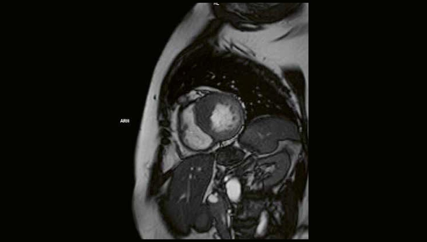 Clinical case MRI Cardiology imaging 2026