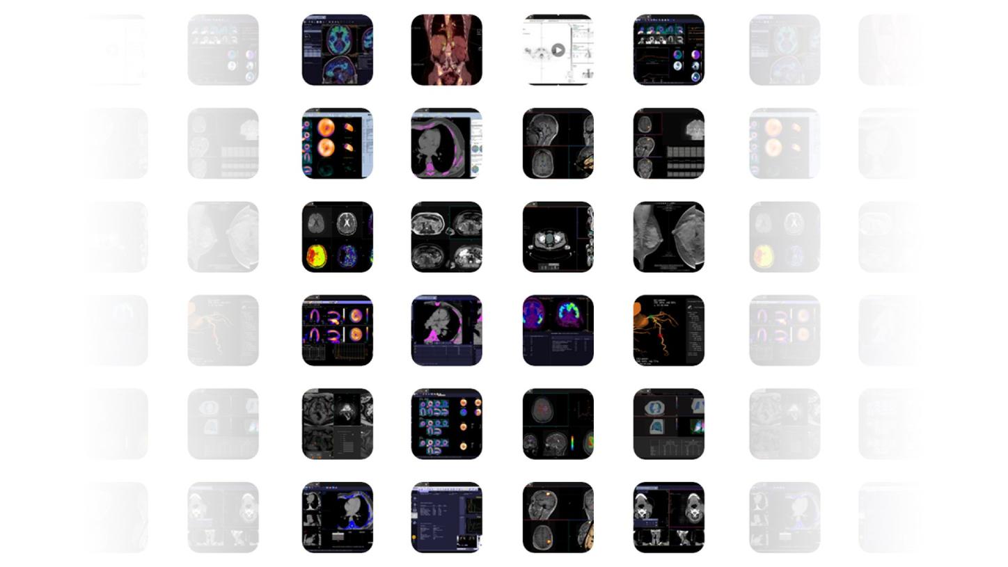 siemens-healthineers_syngo-carbon-flexinity