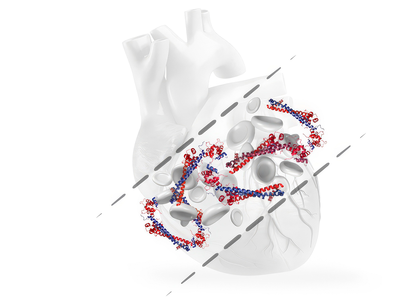 Prognosis for Adverse Events in Suspected ACS Without MI, and Subgroups With or Without History of Incident and Previous MACE Using the Atellica IM High-Sensitivity Troponin I Assay