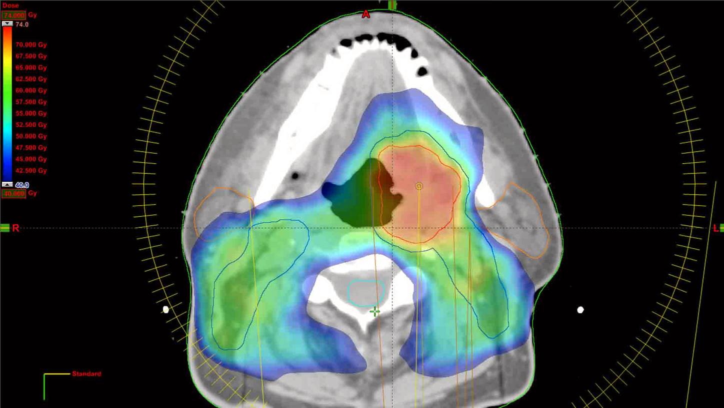 CS501EU-Varian Advanced Techniques Clinical School (IMRT/RapidArc®)