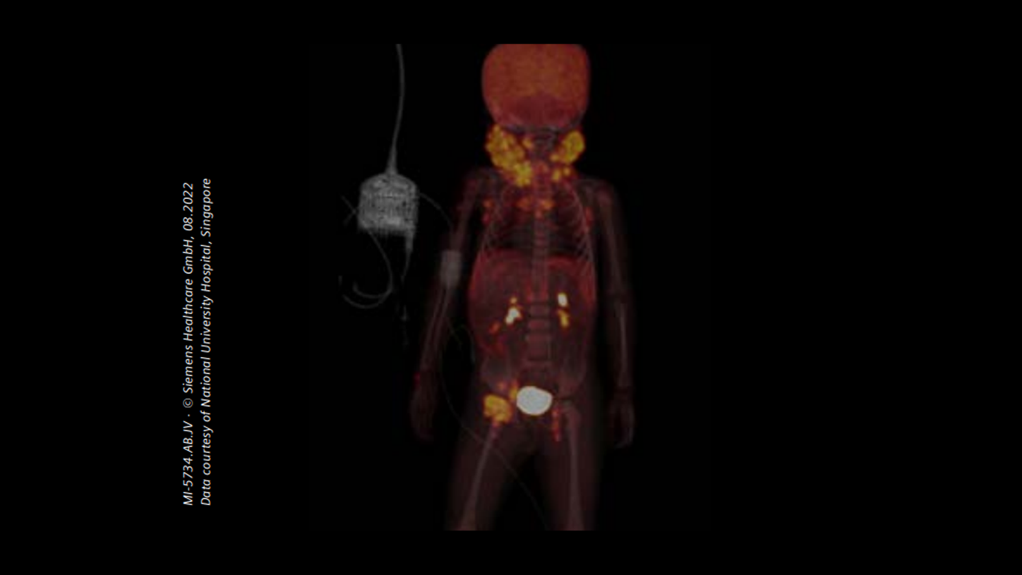 Free educational webinar: Pediatric Challenges in PET/CT