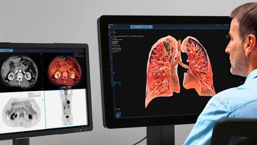 Computed Tomography