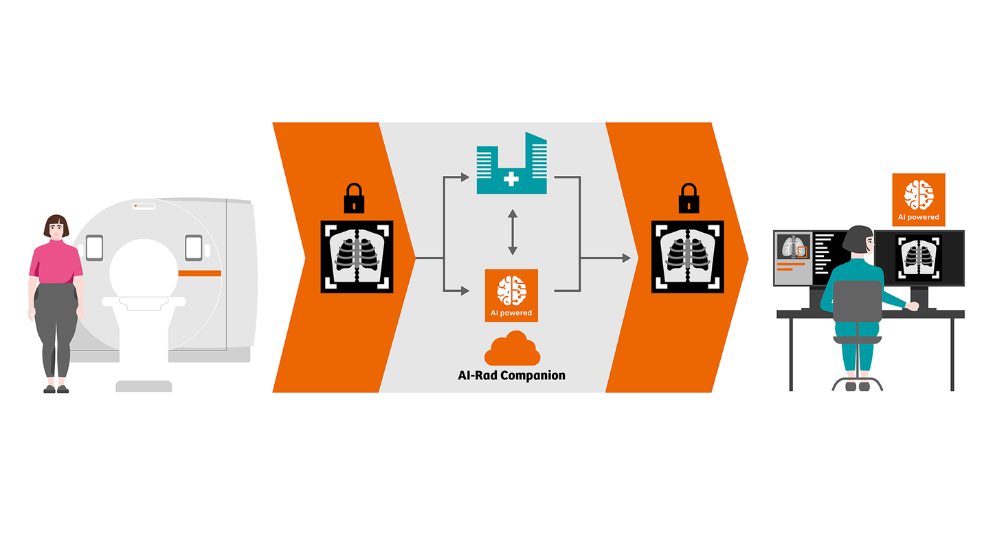 AI in lung cancer care