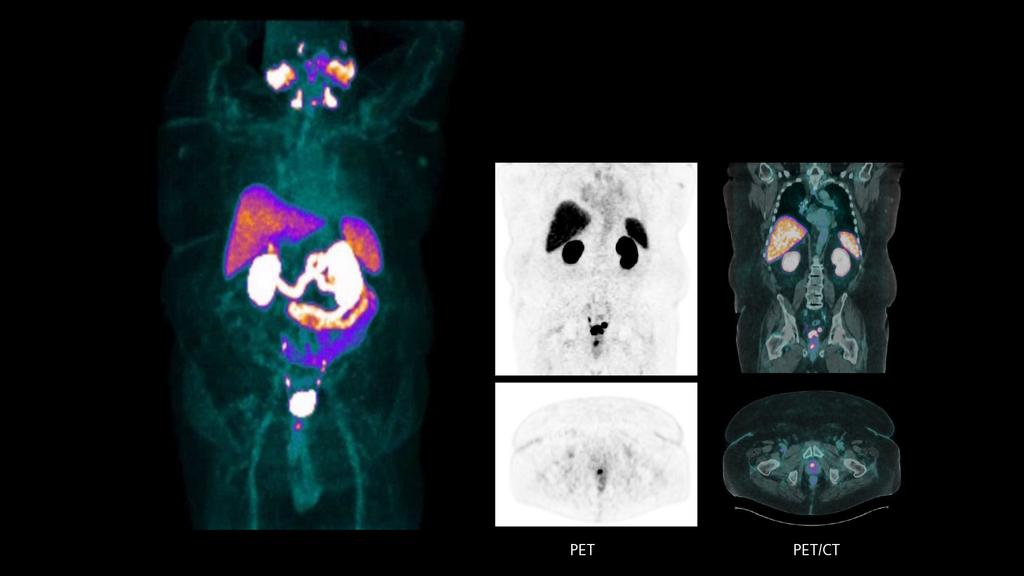Biograph Trinion PET/CT scanner - Siemens Healthineers