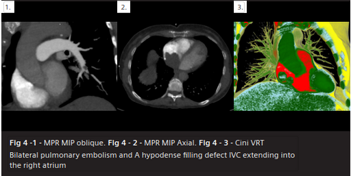 Clinical Perspectives on Modern Spectral and Dual-Source Imaging