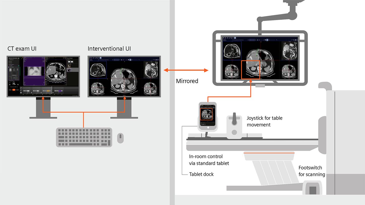 The presentation showcases the hardware setup in both the control room and the examination room, which are available on CT scanners from Siemens Healthineers. 