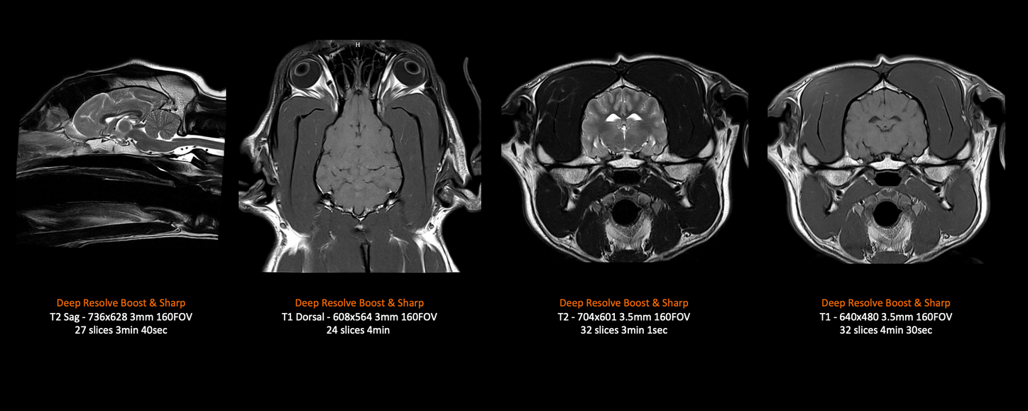 MAGNETOM Flow – 30kg Dog Brain