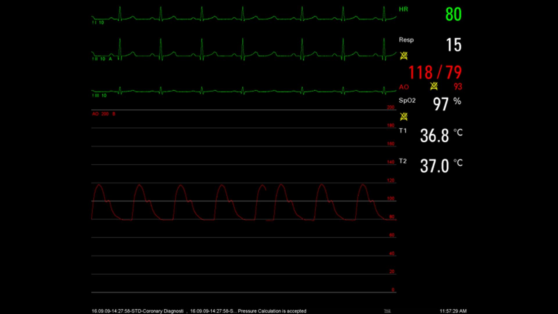 Sensis Vibe - Siemens Healthineers