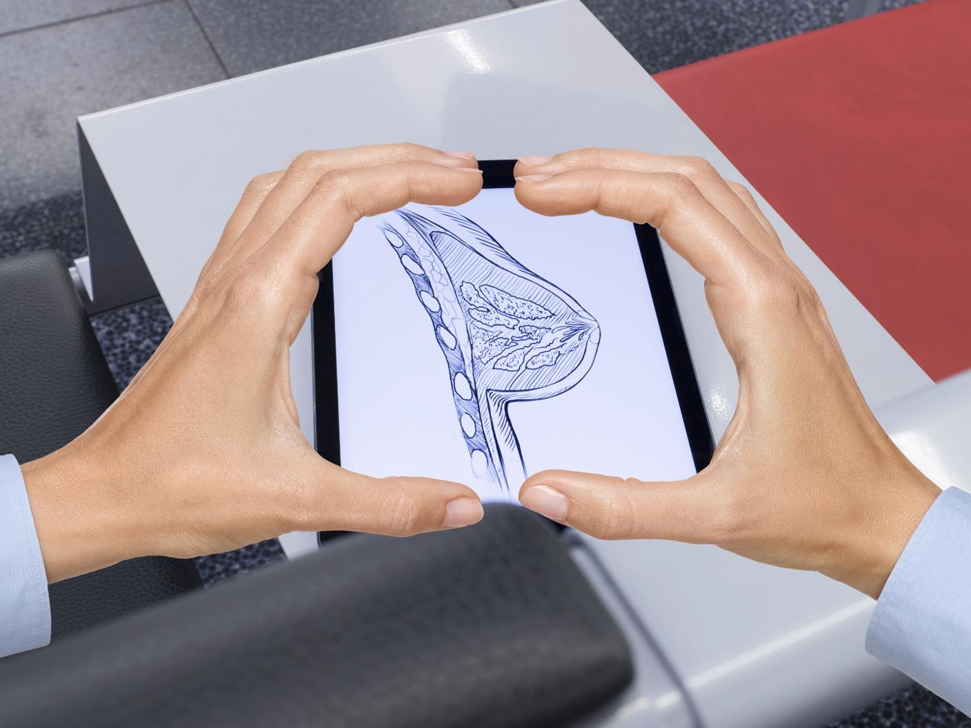 BreastCancer_TeaserImage-