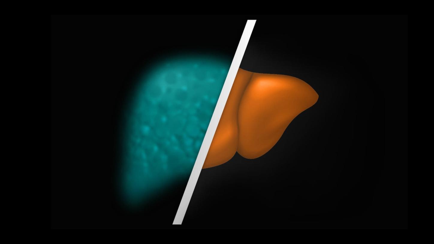 ELF Test Liver graphic