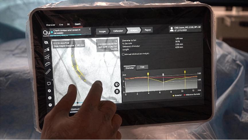 ARTIS pheno.vision Touch UI clinical image